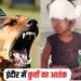 Indore Dog Attack