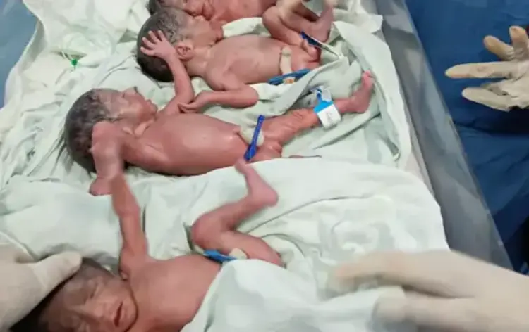 Bhopal Quadruplet Birth
