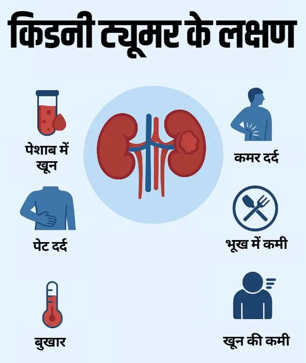 Kidney Tumor symptoms