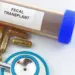 Fecal Transplant