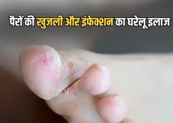 Monsoon Foot Care Tips