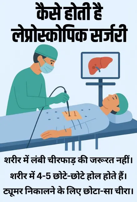laparoscopic surgery